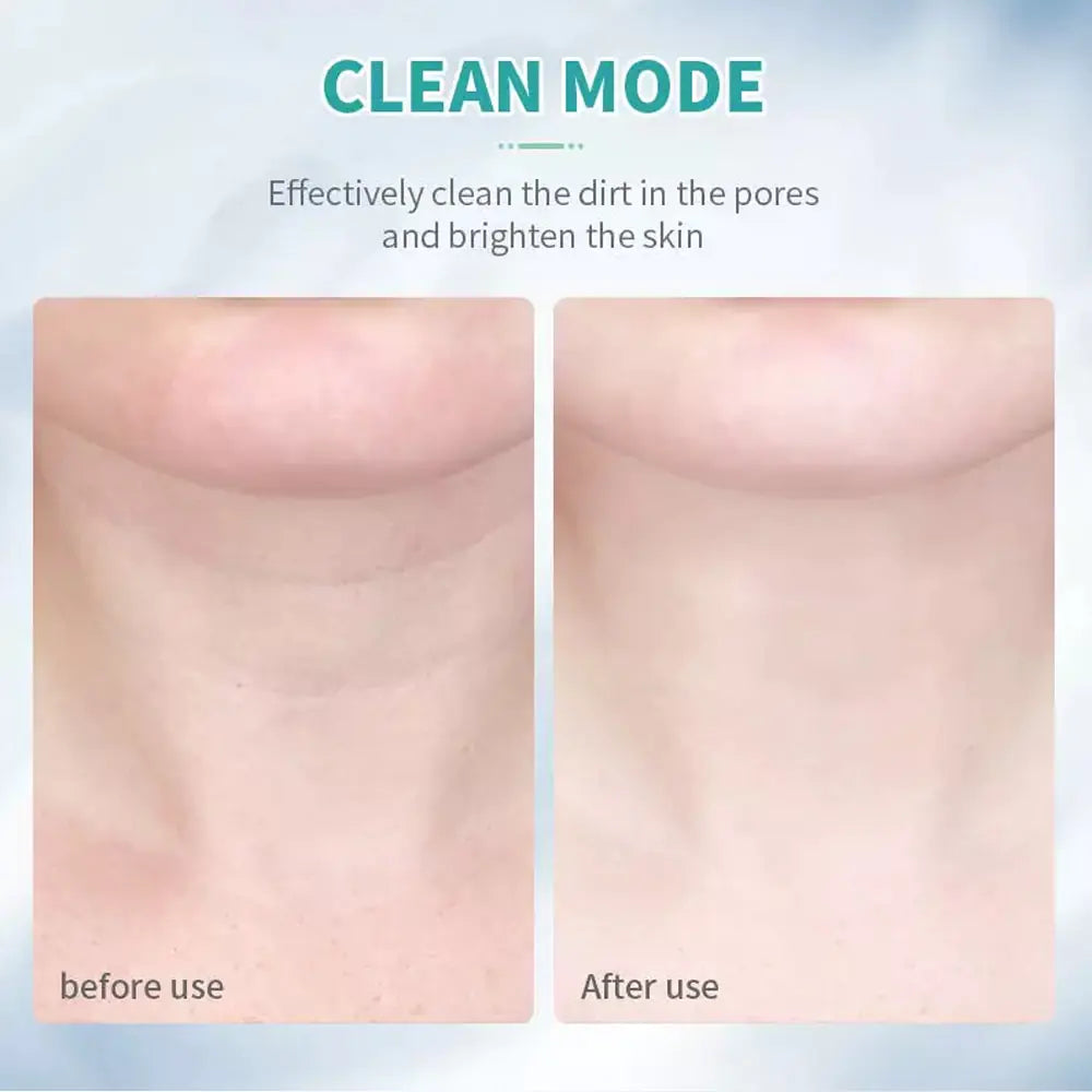 SmoothPro | Anti-Falten- und Facelift-Massagegerät für Gesicht und Hals
