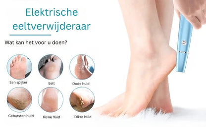 SilkStride™ – Sorgen Sie für weiche Füße, die Sie stolz zeigen können!