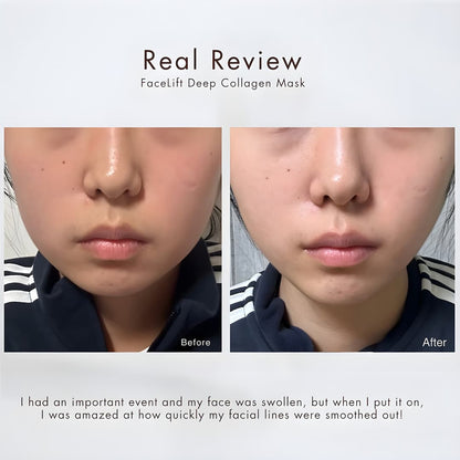 HydraLift™ – Straffere Haut in nur einem Tag!