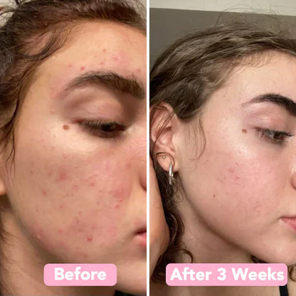 GoldenGlow™ – Saubere und natürlich gereinigte Haut