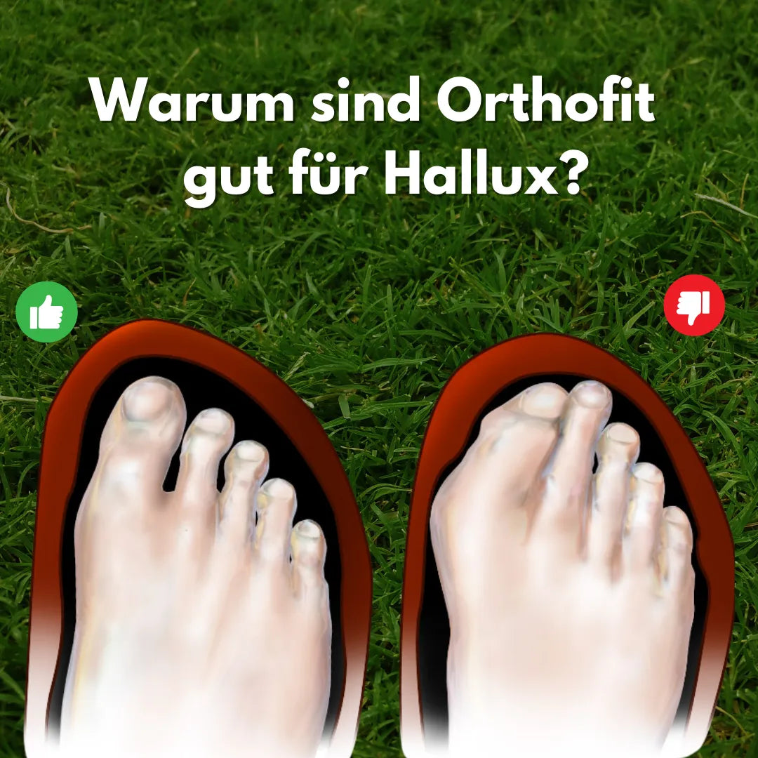 Orthofit Hallux – ergonomische & schmerzlindernde Hallux Valgus Schuhe