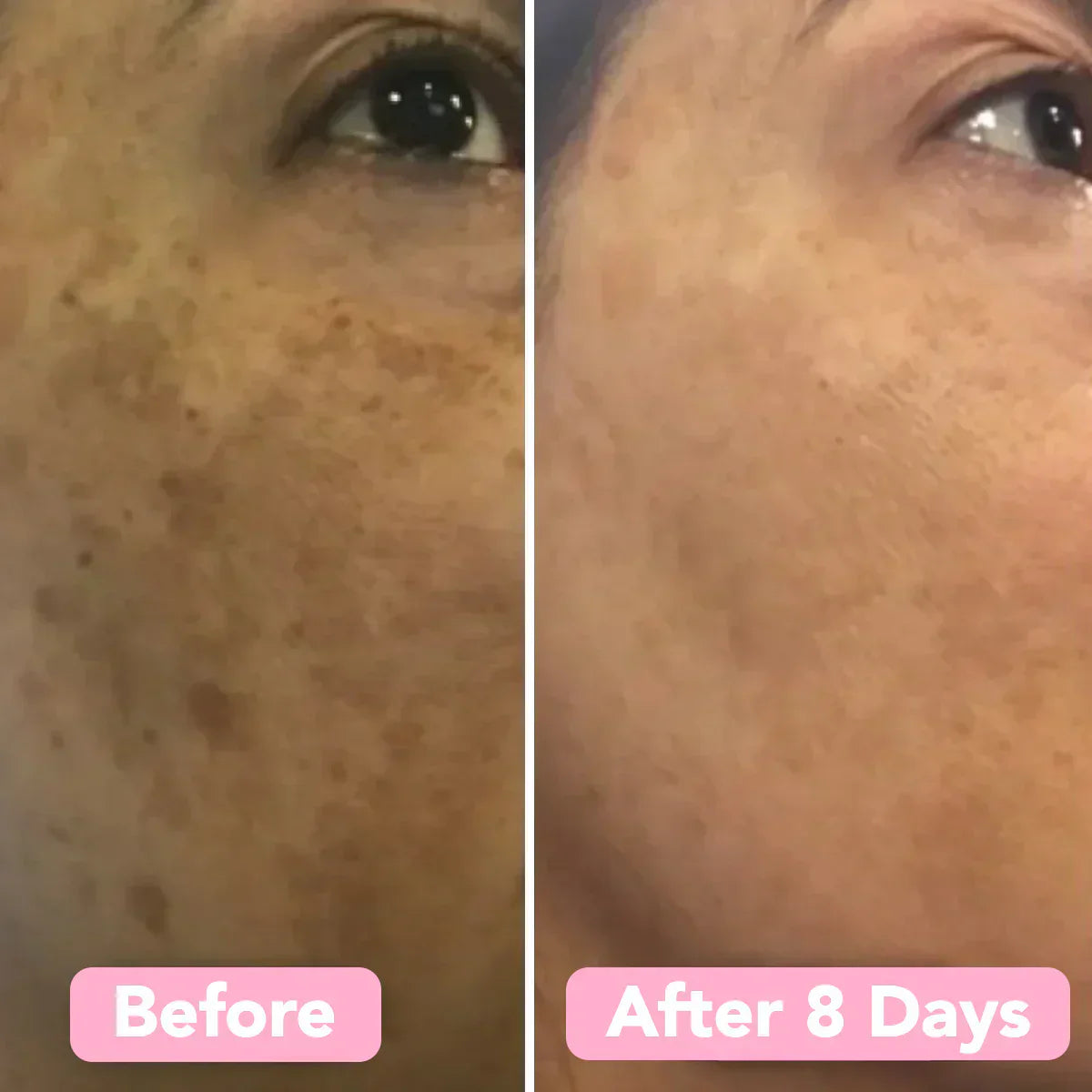 GoldenGlow™ – Saubere und natürlich gereinigte Haut