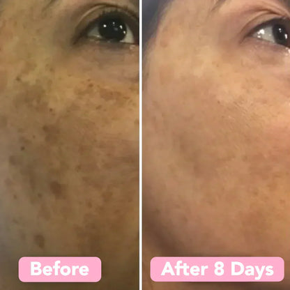 GoldenGlow™ – Saubere und natürlich gereinigte Haut