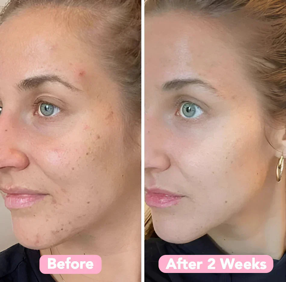 GoldenGlow™ – Saubere und natürlich gereinigte Haut