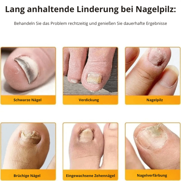 PureNail™ Optimale Wiederherstellung Ihrer Nägel