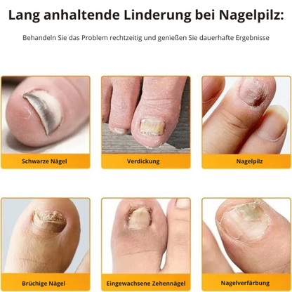 PureNail™ Optimale Wiederherstellung Ihrer Nägel